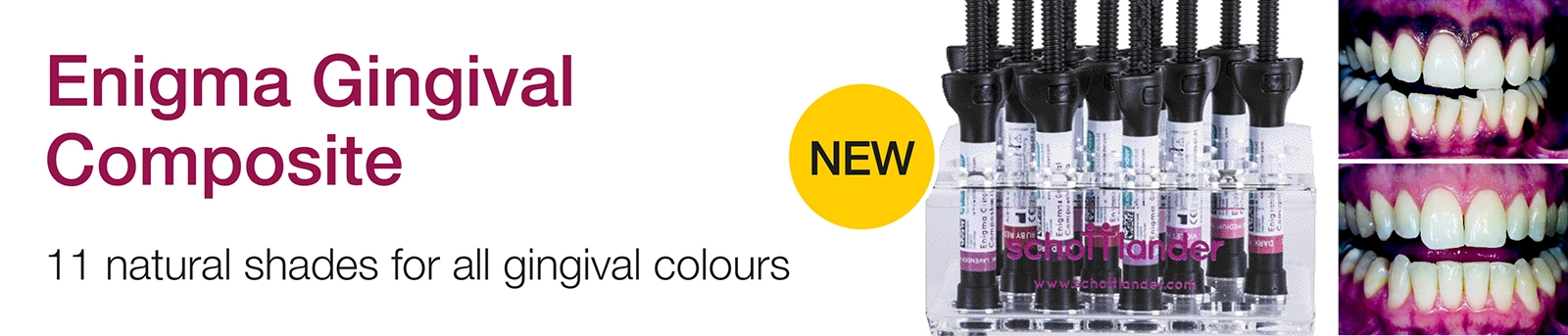 Prosthetics: Acrylics & Ancillaries